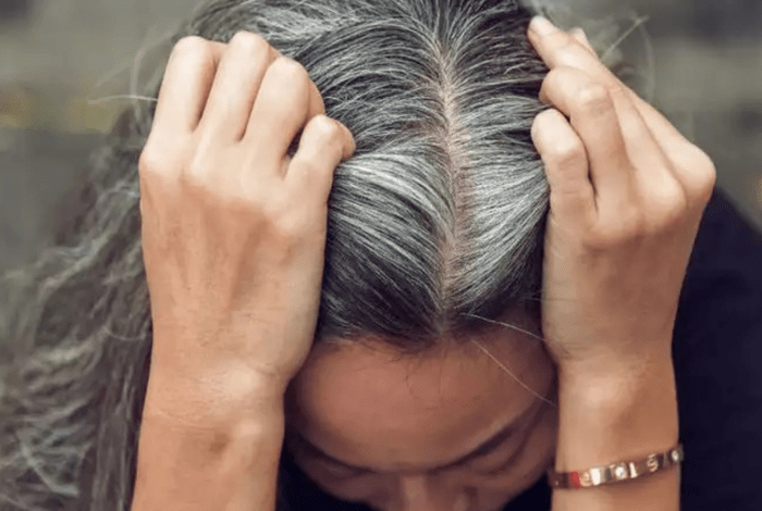 Hair Care Tips Get rid of white hair by adopting these remedies