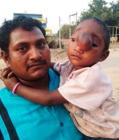 Chhattisgarh Aditi Treatment