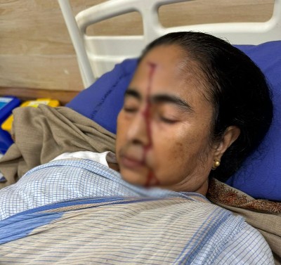 CM Mamata Banerjee Injured