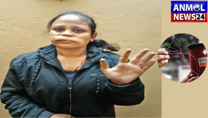 Accident by Chinese Kite